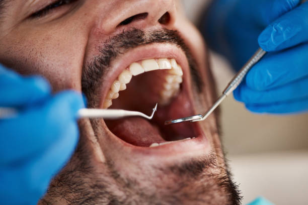 Emergency Dental Services in Crooksville, OH